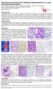 PosterXXXVSEAP007 - Infección por Parvovirus B19: Hallazgos fetoplacentarios en 2 casos de muerte fetal intrautero.