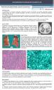 PosterXXXVSEAP009 - Nocardiosis pulmonar en paciente VIH positivo