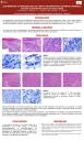 PosterXXXVSEAP020 - Leishmaniasis cutaneomucosa de tracto respiratorio superior (laríngea). Estudio clinicopatológico de dos casos.