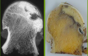 Curso de Patología Osteo-Articular no Tumoral