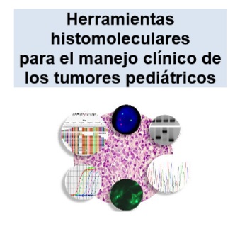 Herramientas Histomoleculares para el Manejo Clínico de los Tumores Pediátricos