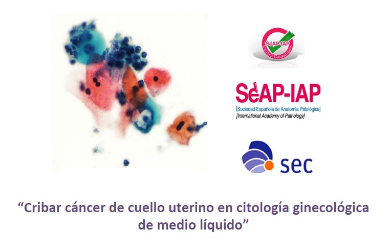 Calidad: "Cribar cáncer de cuello uterino en citología ginecológica de medio líquido"