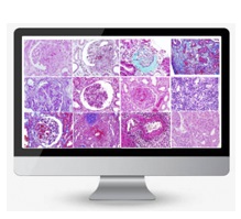 Máster en Patología Renal