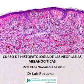 Curso Monográfico sobre Histopatología de las Neoplasias Melanocíticas Benignas y Malignas