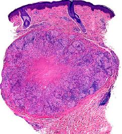 Curso de Introducción a la Dermatopatología