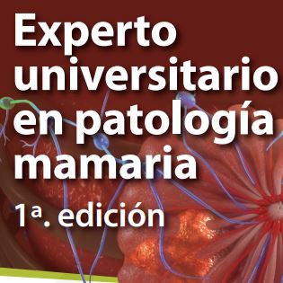 Experto Universitario en Patología Mamaria