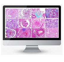 Master online en Patología Renal. Edición V. 2020 - 2021