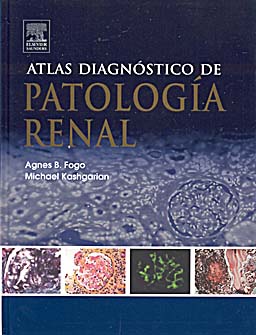 Atlas diagnóstico de patología renal