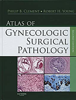 Atlas of Gynecologic Surgical Pathology