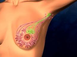 Consenso sobre la biopsia selectiva del ganglio centinela en el cáncer de mama