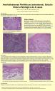Ameloblastomas Periféricos (extraóseos). Estudio Clínico-Patológico de 4 casos.