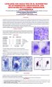 Citología con aguja fina en el diagnóstico de actinomicosis cervicofacial con afectación de la cadena ganglionar laterocervical.