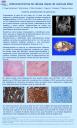 Adenocarcinoma de células claras de vesícula biliar