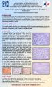 Carcinoma neuroendocrino de tracto gastrointestinal: estudio descriptivo de cinco casos