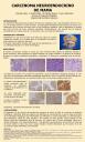 CARCINOMA NEUROENDOCRINO DE MAMA