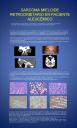 Sarcoma mieloide intraorbitario en paciente aleucémico