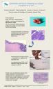 Carcinoma urotelial primario de vagina