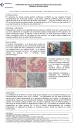 Carcinoma De Células Renales Quístico Multilocular. Reporte De Dos Casos