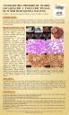 Agiosarcoma primario de ovario: localización y evolución inusual de tumor mesenquimal maligno
