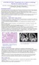 Angiolioma. Presentación de un caso en orofaringe. Revisión de nuestra casuística