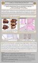 Cistadenoma hepatobiliar mucinoso en edad infantil. A propósito de un caso