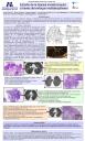Estudio de la biopsia transbronquial a través del enfoque multidisciplinario